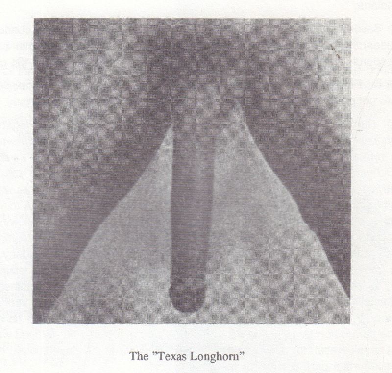 GRIFFIN, Gary. Penis Size and Enlargement: Facts, Fallacies and Proven Methods.